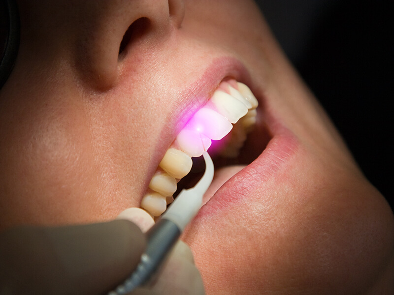 laserterapia