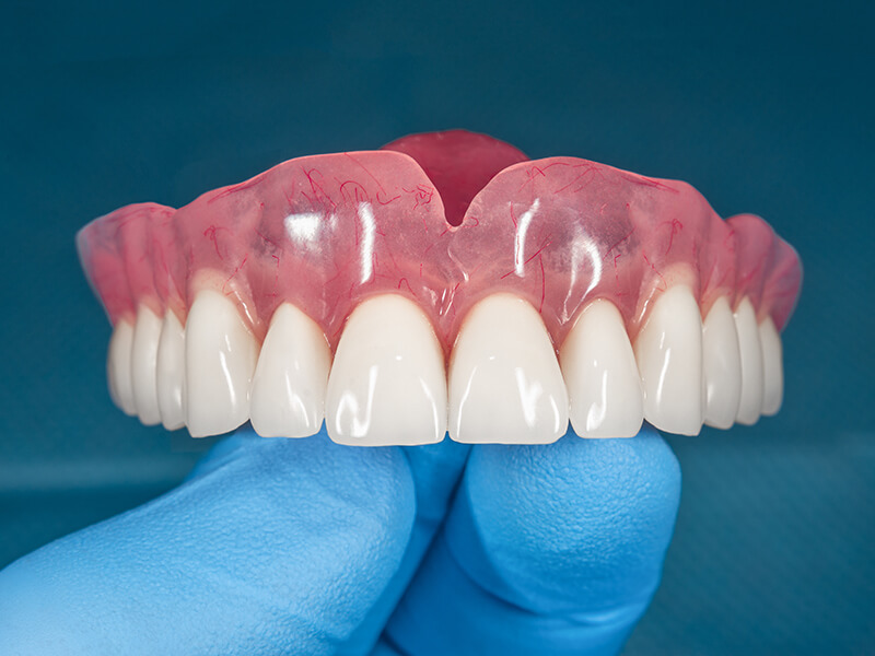 prótese dentária